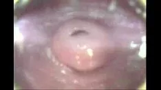 Jouer Blanca carie cam 2